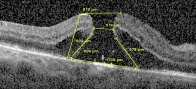 captura de pantalla 2026 03 04 a la(s) 18.01.53