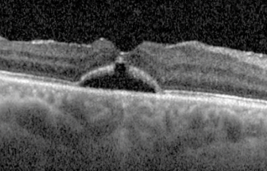 captura de pantalla 2026 03 04 a la(s) 18.02.17